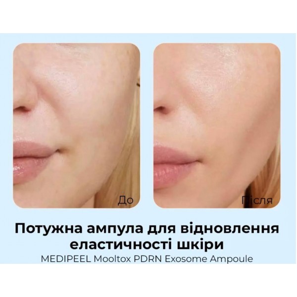 Ser pentru fata cu polinucleotide si fitoexozomi Medi-Peel Mooltox PDRN Exosome Ampoule 50 ml Ser pentru fata cu polinucleotide si fitoexozomi Medi-Peel Mooltox PDRN Exosome Ampoule 50 ml